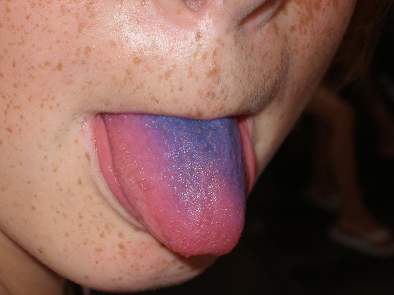 P5250758